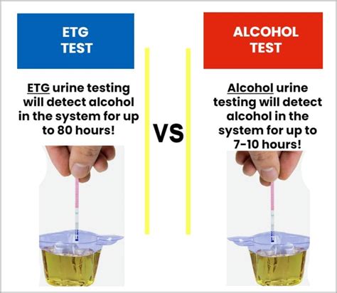 can eye drops pass a alcohol urine test|Urine Alcohol Levels: Chart, Comparison, Other Tests .